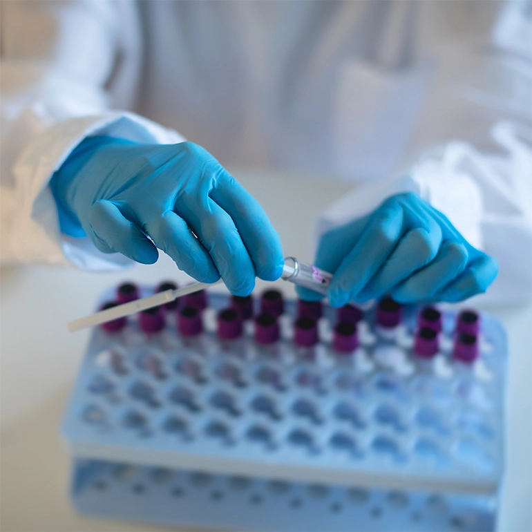 blog-como-es-el-proceso-de-obtencion-transporte-y-resguardo-de-una-muestra